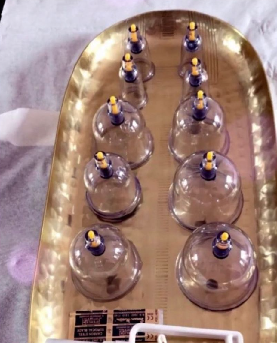 Sunnah Cure | Female Hijama & Wet Cupping Sydney | 11 Balfour Rd, Narwee NSW 2209, Australia | Phone: 0414 839 305