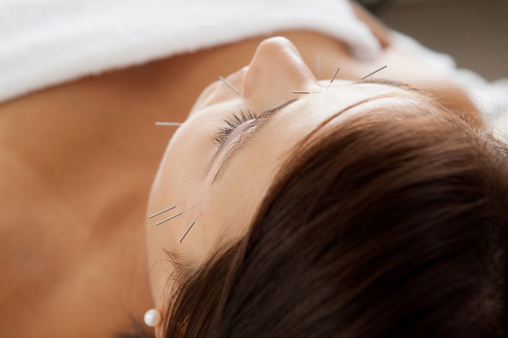 Fusion Acupuncture Brisbane | 455 S Pine Rd, Everton Park QLD 4053, Australia | Phone: 0448 844 551