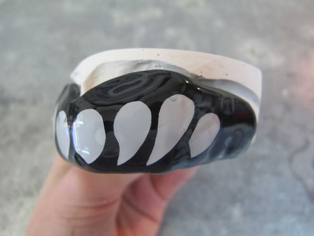 Mouthguards By Patrick | 20C Blackburn Rd, Blackburn VIC 3130, Australia | Phone: (03) 9894 4430