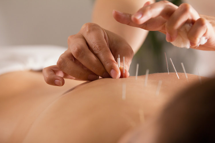 Physiotherapist and Acupuncture Clinic ????‍⚕️- Jessica Maguire | physiotherapist | 22 Fawcett St, Brunswick Heads NSW 2483, Australia | 0266851646 OR +61 2 6685 1646