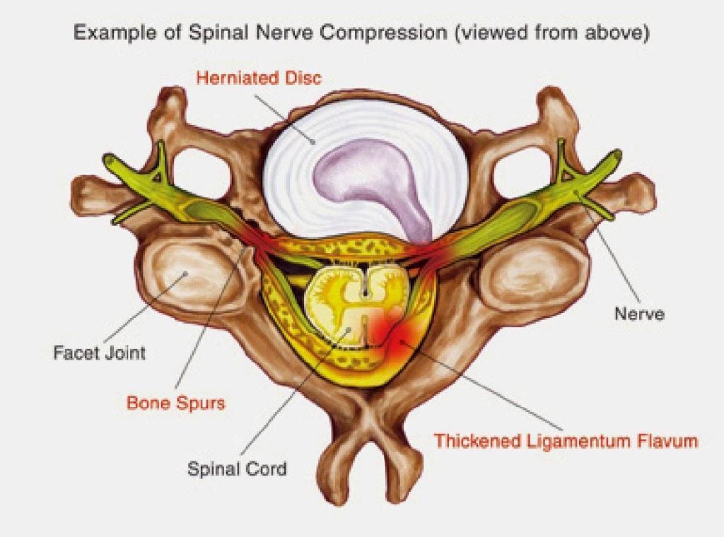 Hunter Spine and Arthroplasty Centre | 3/173 Chisholm Rd, Ashtonfield NSW 2323, Australia | Phone: (02) 4934 2955