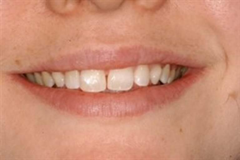 Carlton Dental | dentist | 184 Elgin St, Carlton VIC 3053, Australia | 0393472033 OR +61 3 9347 2033