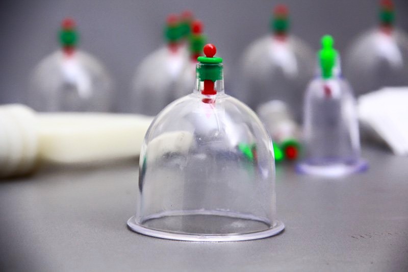 Hijama-Cupping U&A | point of interest | 8 Chelsea Ct, Burnside Heights VIC 3023, Australia | 0457860515 OR +61 457 860 515