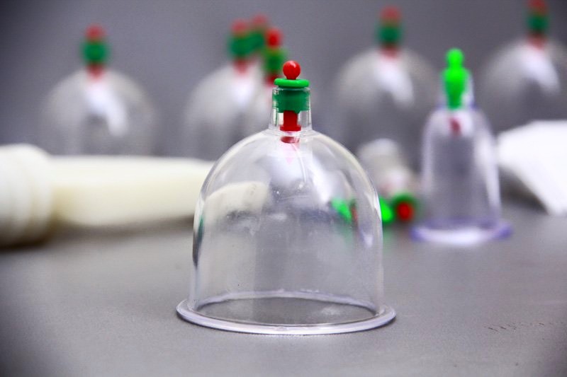 Hijama-Cupping U&A | 8 Chelsea Ct, Burnside Heights VIC 3023, Australia | Phone: 0457 860 515