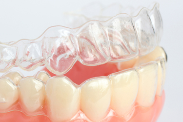 Bruce Mackay Dentures - Dental Technician & Prosthetist | Dentur | health | We cover Penrith, Cambridge Park, Kingswood, Werrington, Cranebrook, St Marys, Blue Mountains, Springwood, Winmalee, Blaxland, Glenbrook, Emu Plains Blacktown, Rooty Hill, Mount Druitt, Doonside, Seven Hills, Kings Langley, 40 Rodley Ave, Penrith NSW 2750, Australia | 0247214090 OR +61 2 4721 4090