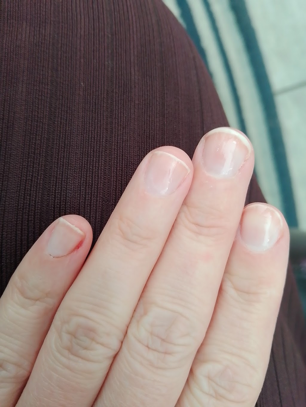 B&T Nails | Kangaroo Flat VIC 3555, Australia | Phone: (03) 5447 2759