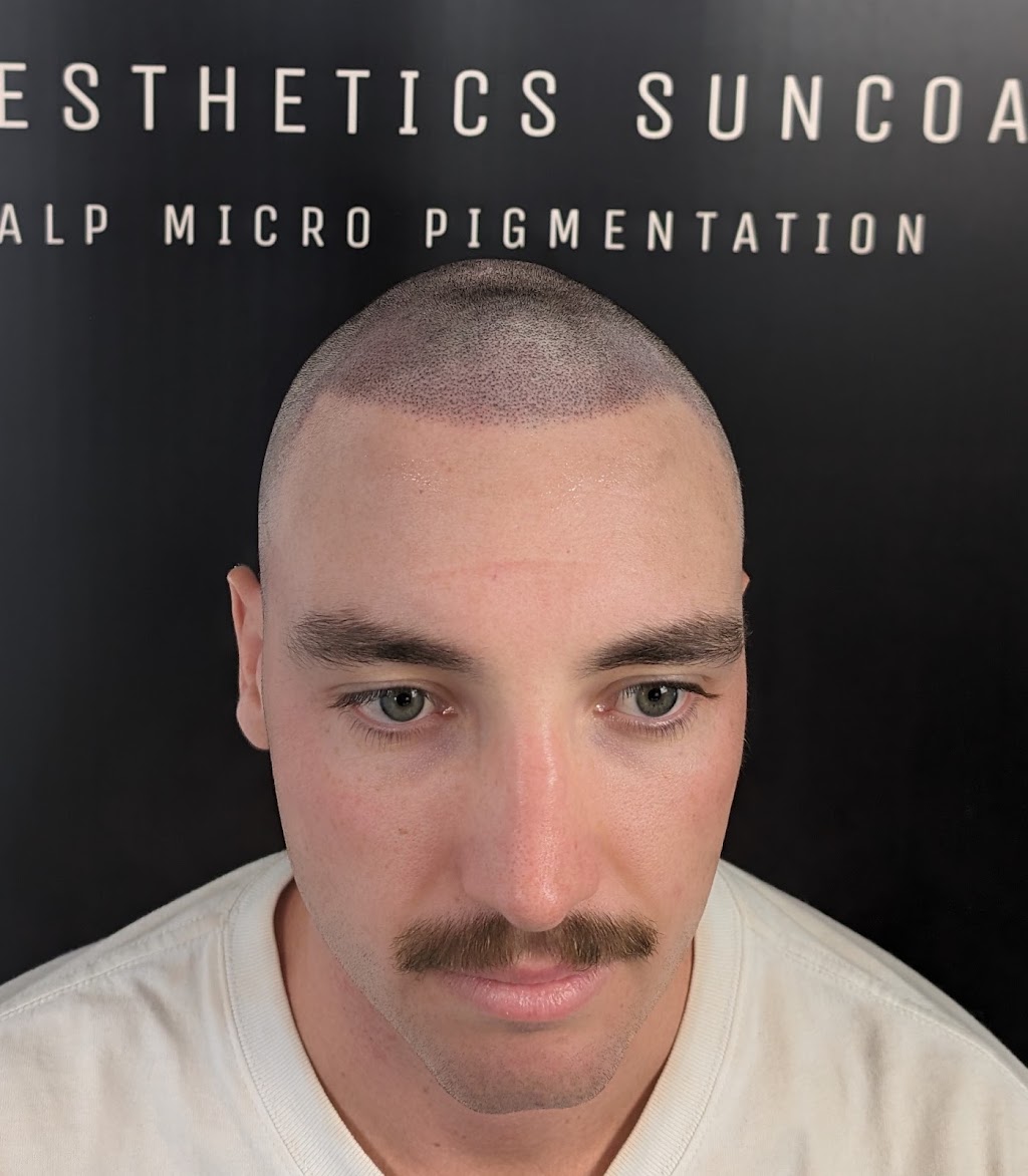 Smp Aesthetics Suncoast | 42 Ngungun Cr, Glass House Mountains QLD 4518, Australia | Phone: 0434 320 318