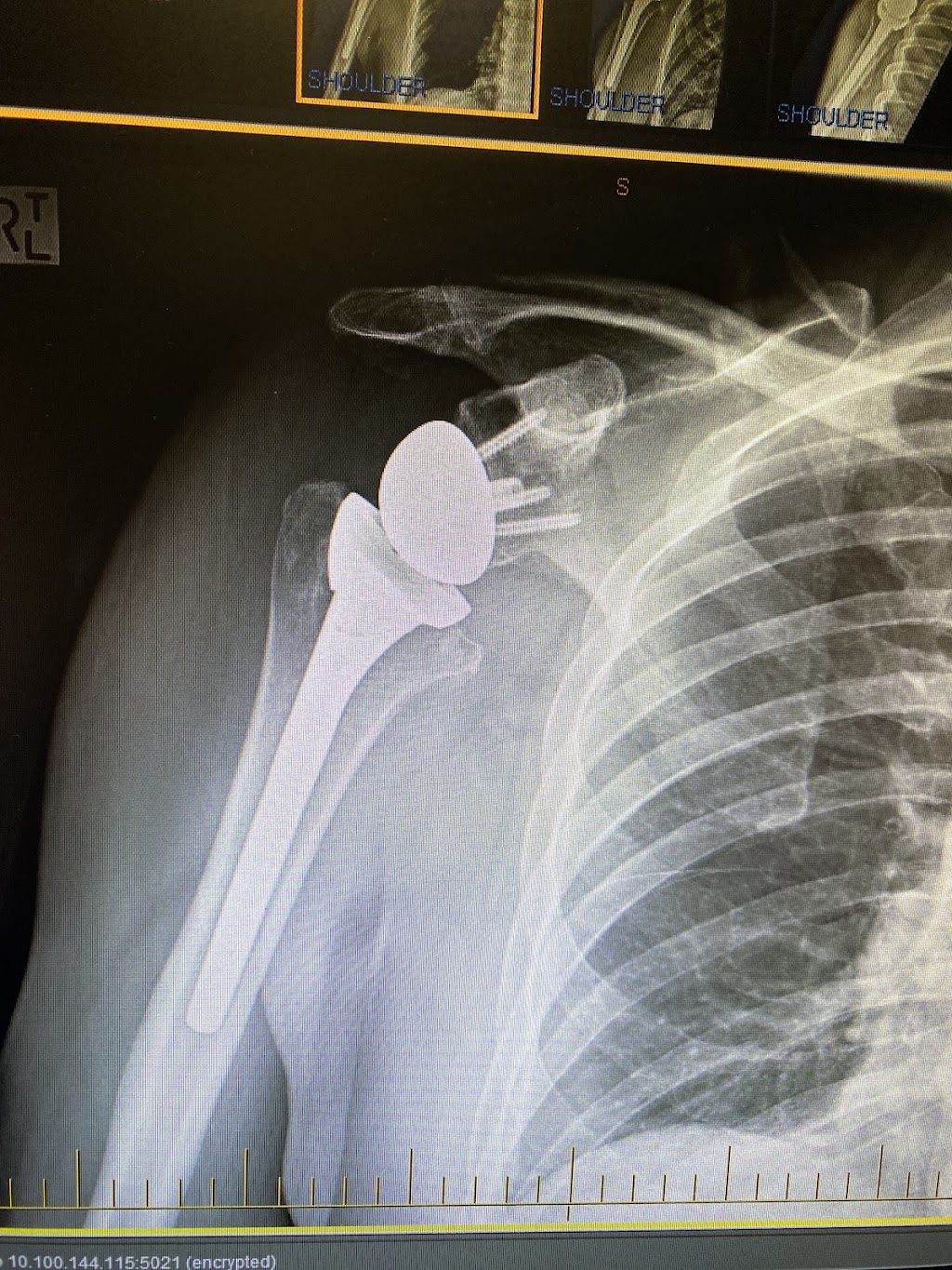 Westgippsland Orthopaedics | 41 Landsborough St, Warragul VIC 3820, Australia | Phone: (03) 5623 0810