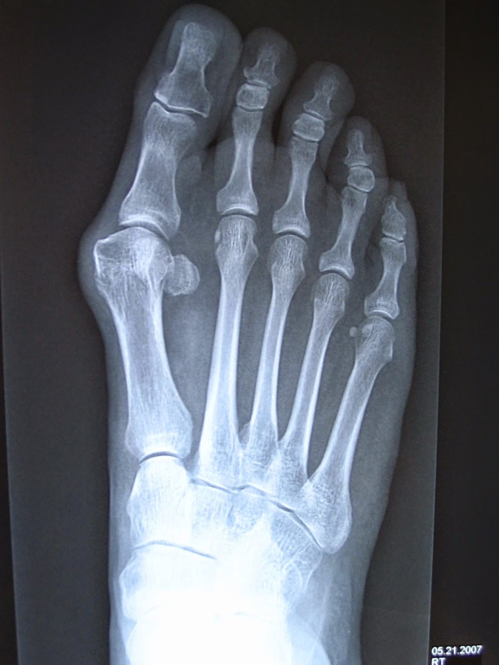 Foot & Leg pain Clinics | doctor | 137 Moondarra Dr, Berwick VIC 3806, Australia | 1300328300 OR +61 1300 328 300
