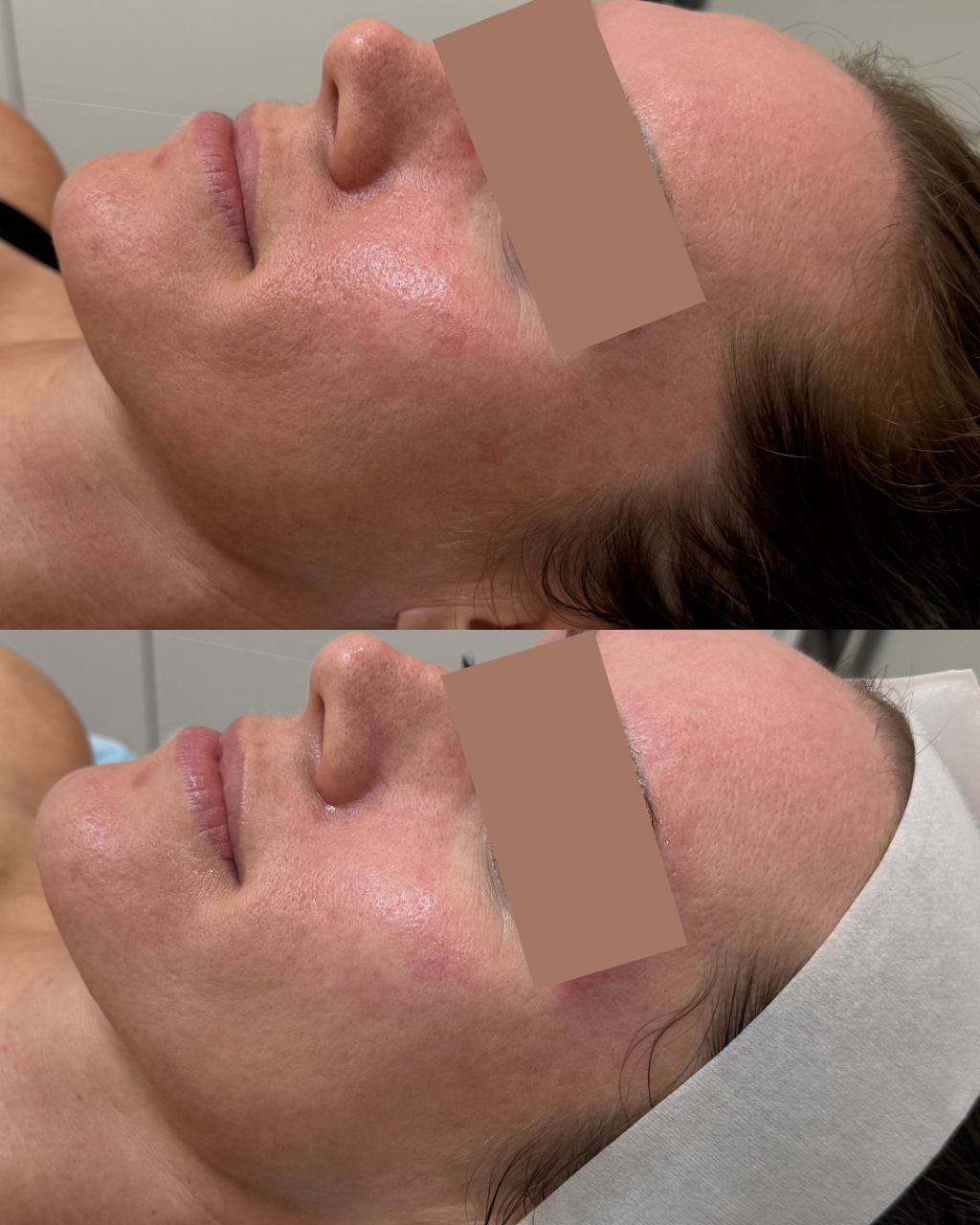 Unspoken Skin & Brows | 11/459 Pumicestone Rd, Caboolture QLD 4510, Australia | Phone: 0455 100 240