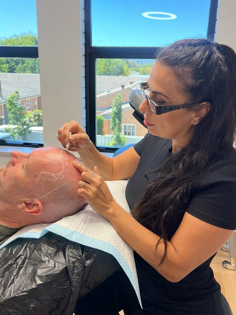 Scalp Canvas - Scalp Micropigmentation Sydney | 1 Inverness Cct, Cecil Hills NSW 2171, Australia | Phone: 0414 400 454