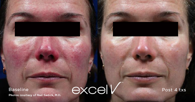Medical Skin and Laser | doctor | 3/37 Elizabeth St, Kalamunda WA 6076, Australia | 0862931066 OR +61 8 6293 1066