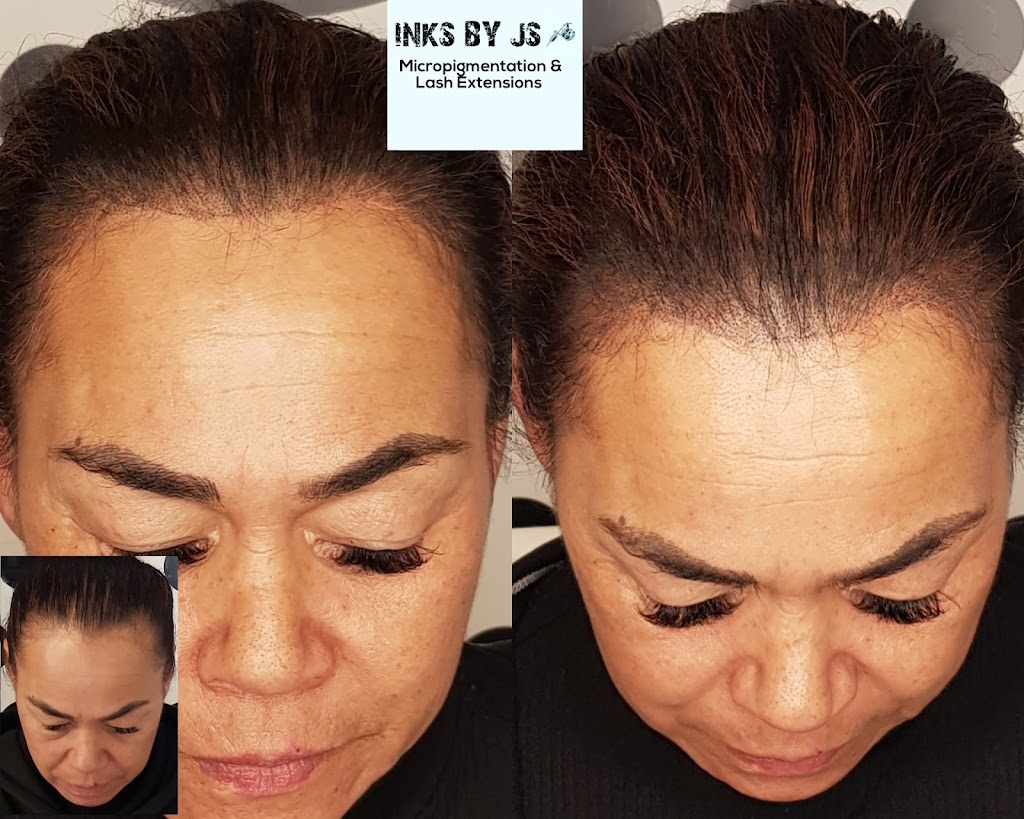 Scalp Micropigmentation SMP Melbourne Inks by JS | Sayers Rd, Tarneit VIC 3029, Australia | Phone: 0421 844 551