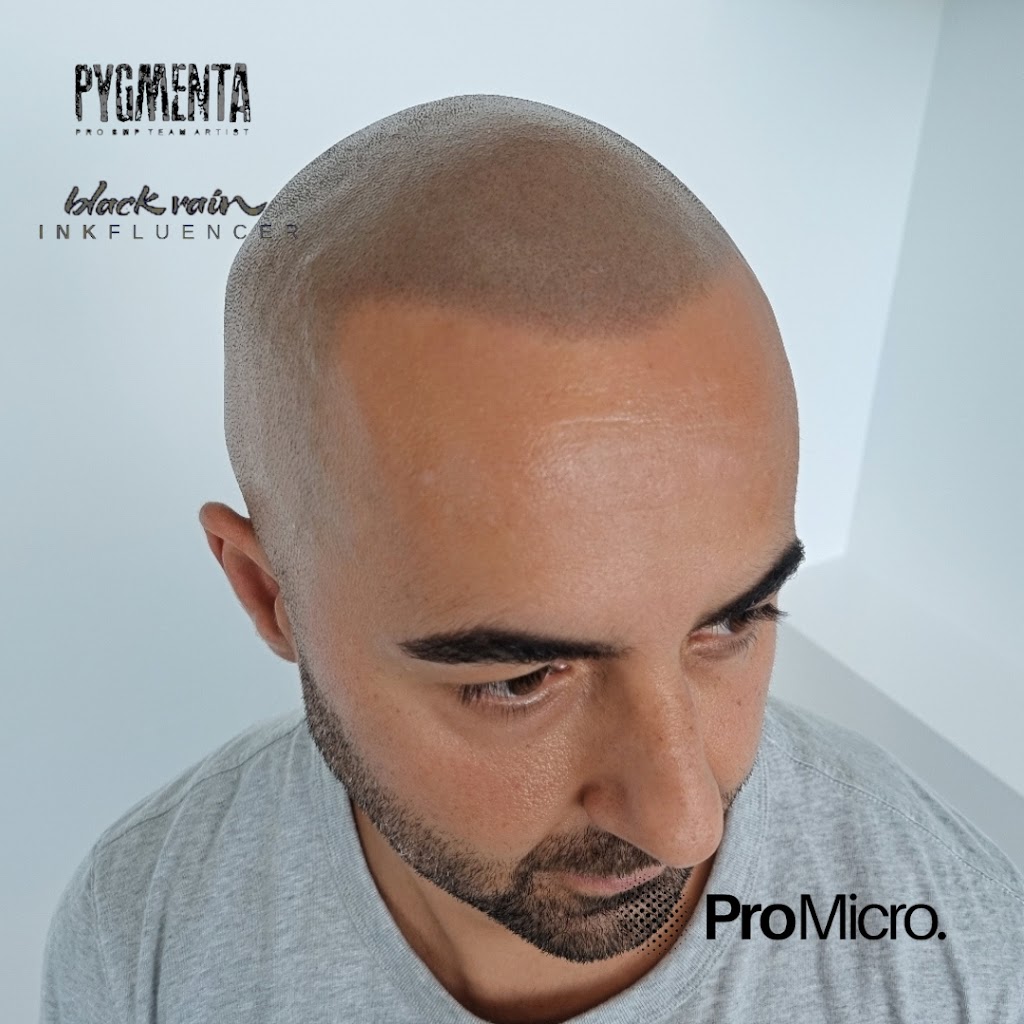 Pro Micro - Scalp Micropigmentation SMP | 23/58 Riverwalk Ave, Robina QLD 4226, Australia | Phone: 0437 778 852