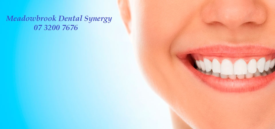 Meadowbrook Dental Synergy | Shop 13 6/10 Logandowns Dr, Meadowbrook QLD 4131, Australia | Phone: (07) 3200 7676