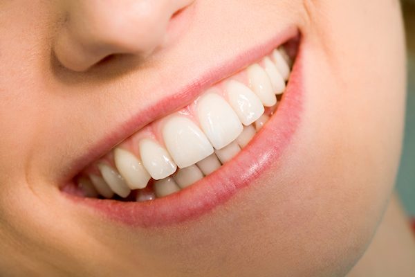 Pearl White Smile | dentist | 6 Fletcher St, Essendon VIC 3040, Australia | 0416102477 OR +61 416 102 477