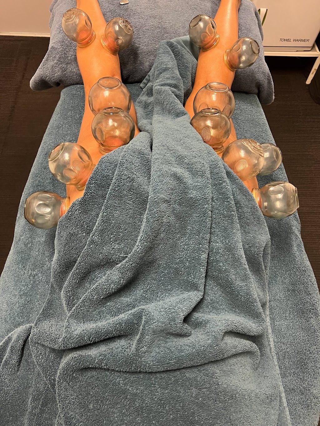 MyoFix Therapy | 1 Monckton Pl, Glenfield NSW 2167, Australia | Phone: 0430 548 866