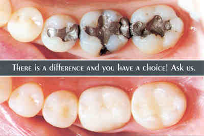 Diamond Dental | dentist | 2 Renou Rd, Wantirna South VIC 3152, Australia | 0398874447 OR +61 3 9887 4447