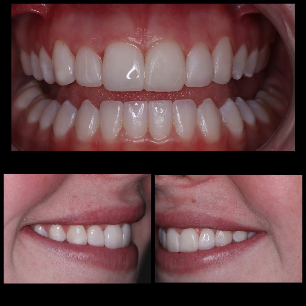 Cloud Nine Dental Glenmore Park | Shop 1b/90 Glenmore Ridge Dr, Glenmore Park NSW 2745, Australia | Phone: (02) 4713 1806