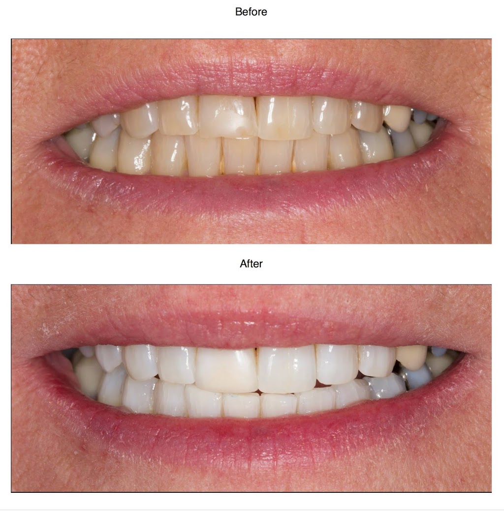 Myrtle Bank Dental | dentist | 320 Glen Osmond Rd, Myrtle Bank SA 5064, Australia | 0883794872 OR +61 8 8379 4872