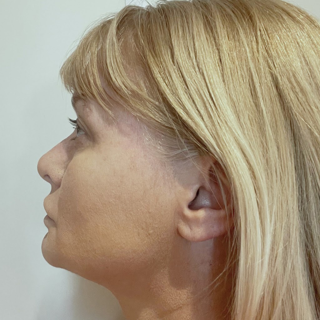 Replenish Co - Anti-Wrinkle Clinic Bathurst | 240 William St, Bathurst NSW 2795, Australia | Phone: 0458 706 785