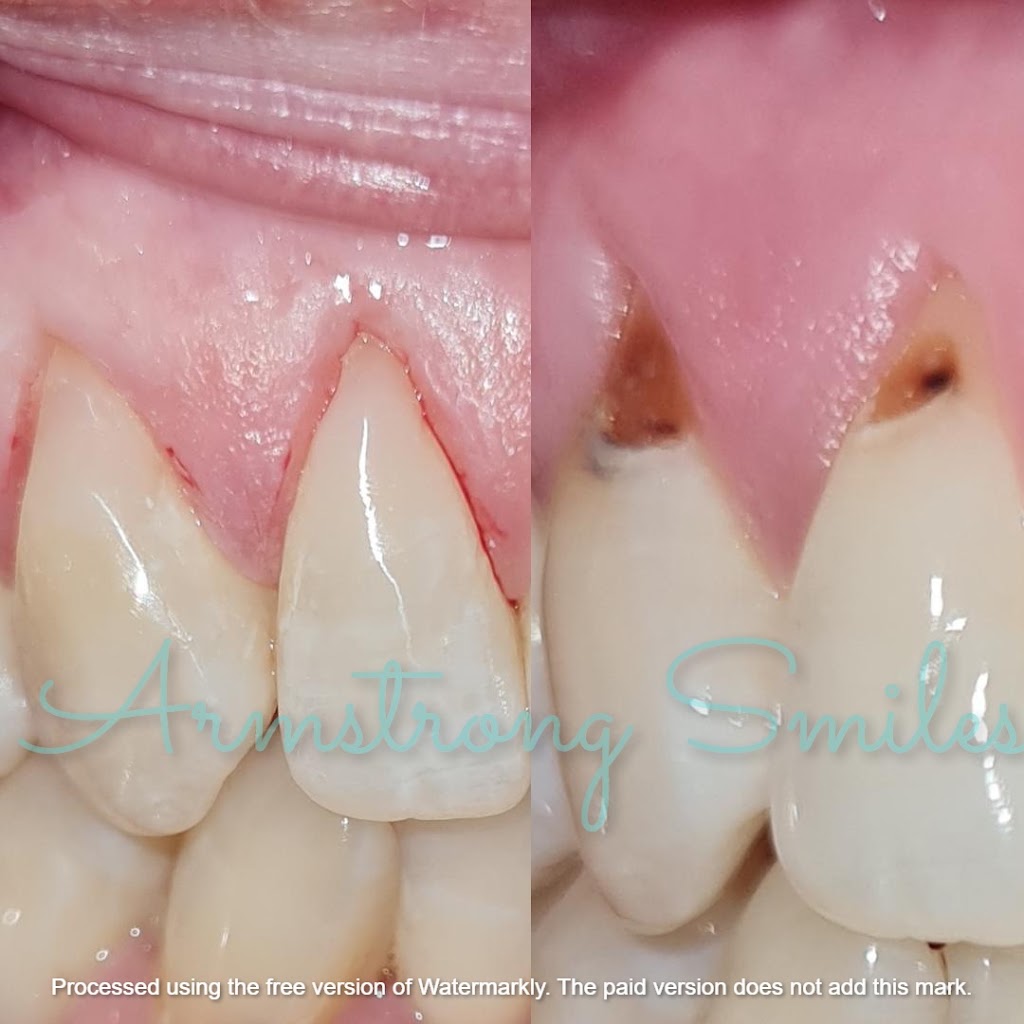 Armstrong Smiles | T01/500 - 540 Torquay Rd, Armstrong Creek VIC 3217, Australia | Phone: (03) 5215 1333