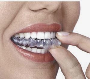 Dentures Sunnybank | dentist | 73 Ardargie St, Sunnybank QLD 4109, Australia | 0733453542 OR +61 7 3345 3542