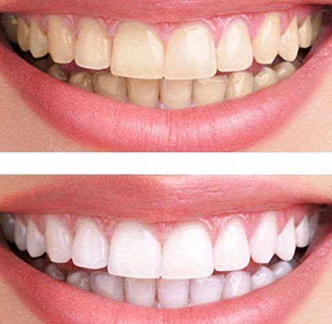 Kite Street Dental | dentist | 51 Kite St, Orange NSW 2800, Australia | 0263628770 OR +61 2 6362 8770