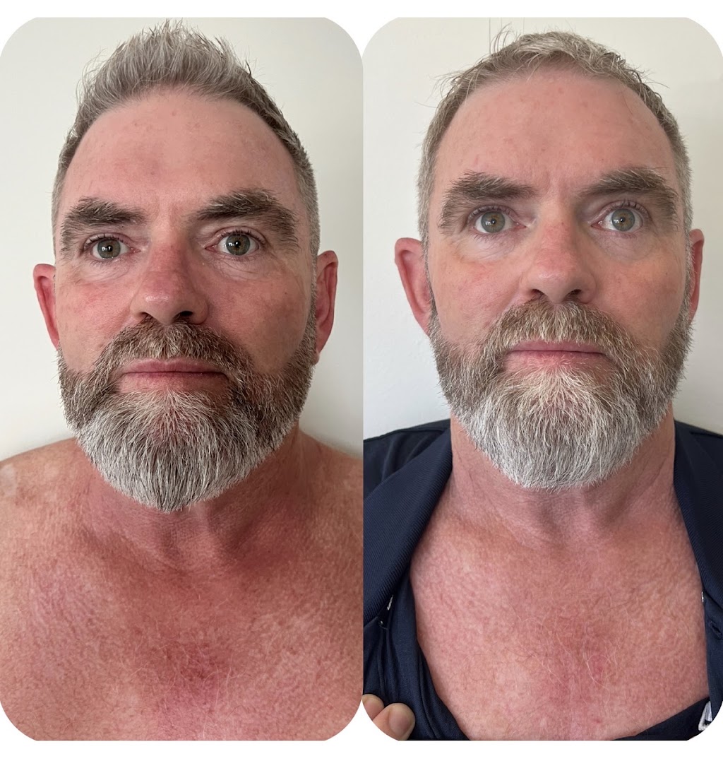 LJ Aesthetics | 1/93 Marine Parade, Redcliffe QLD 4020, Australia | Phone: 0423 957 558