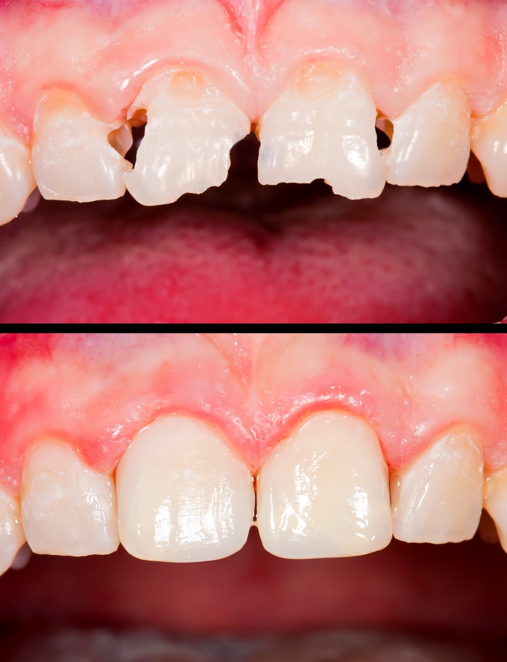 Village Dental - All General, Cosmetic, Implant & Orthodontic De | dentist | 22 Primmer Ct, Kambah ACT 2902, Australia | 0262317065 OR +61 2 6231 7065