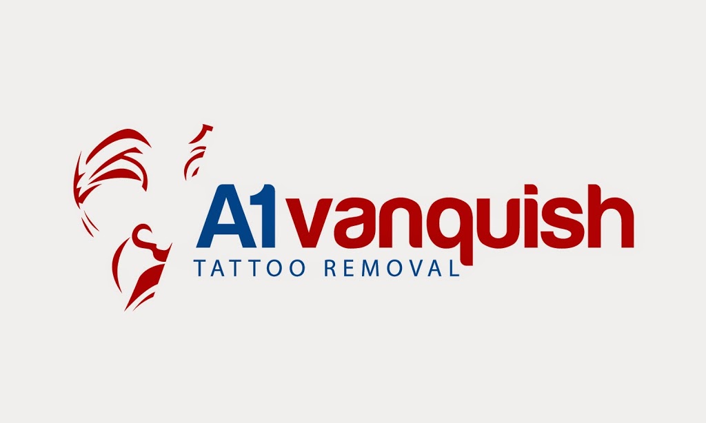 A1 Vanquish Tattoo Removals |  | 2/33 Kildonan St, Aspley QLD 4034, Australia | 0733124481 OR +61 7 3312 4481