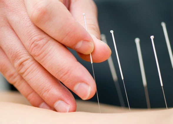 Kylie Stabler Acupuncture | 7 Blyth St, Brunswick VIC 3056, Australia | Phone: 0415 607 986