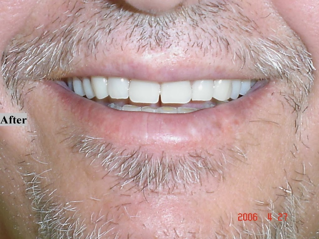 Robert Collins Dental Prosthetist | dentist | 80 Nebo Rd, West Mackay QLD 4740, Australia | 0749577144 OR +61 7 4957 7144