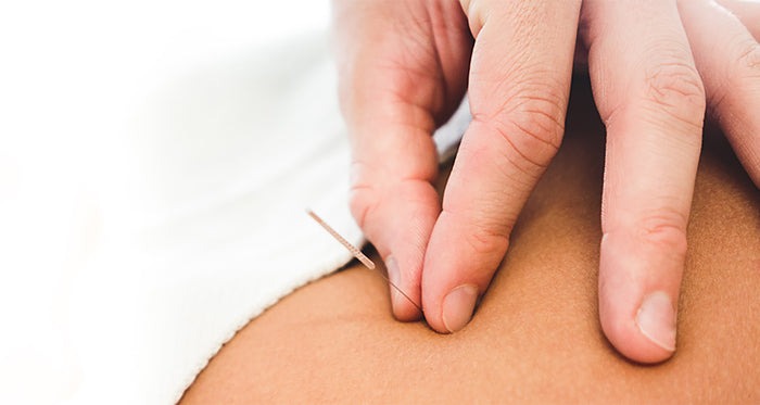 Vyne Health Acupuncture Gold Coast | Suite 9/2098 Gold Coast Hwy, Miami QLD 4220, Australia | Phone: (07) 5515 0409