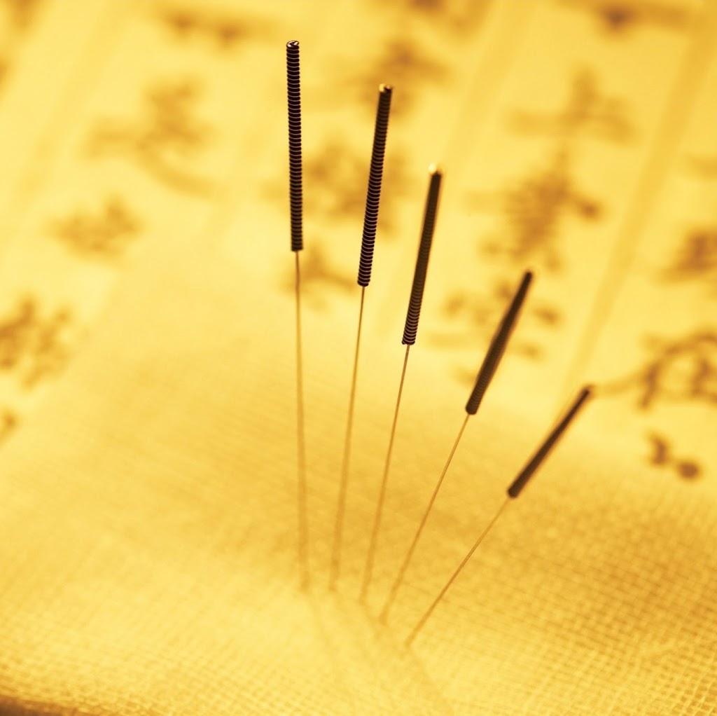 Toowoomba Chinese Acupuncture & Herbal Medicine Clinic | 5 Pottinger St, Newtown QLD 4350, Australia | Phone: (07) 4638 2885