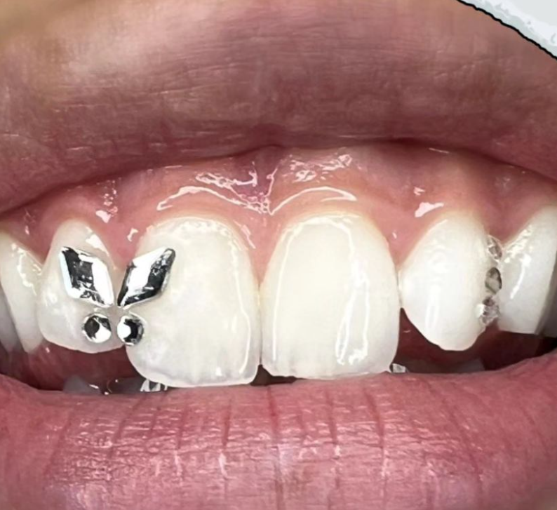 Luxe Smile Beauty | 6 Garema Rd, Gwandalan NSW 2259, Australia | Phone: 0412 922 689