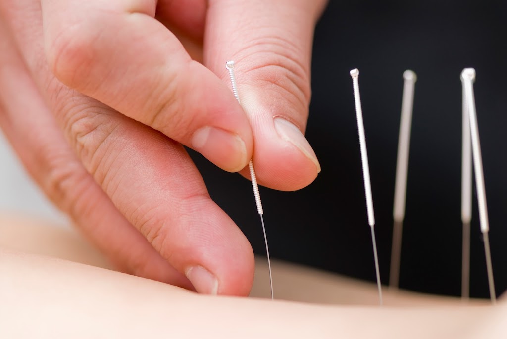 Rachel Wise (T/A Red Onyx Acupuncture) | 594 Rode Rd, Chermside QLD 4032, Australia | Phone: 0479 089 277