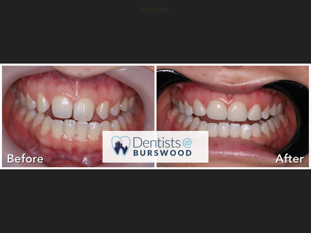 Dentists@Burswood | dentist | 1/107-109 Orrong Rd, Rivervale WA 6103, Australia | 0893612796 OR +61 8 9361 2796