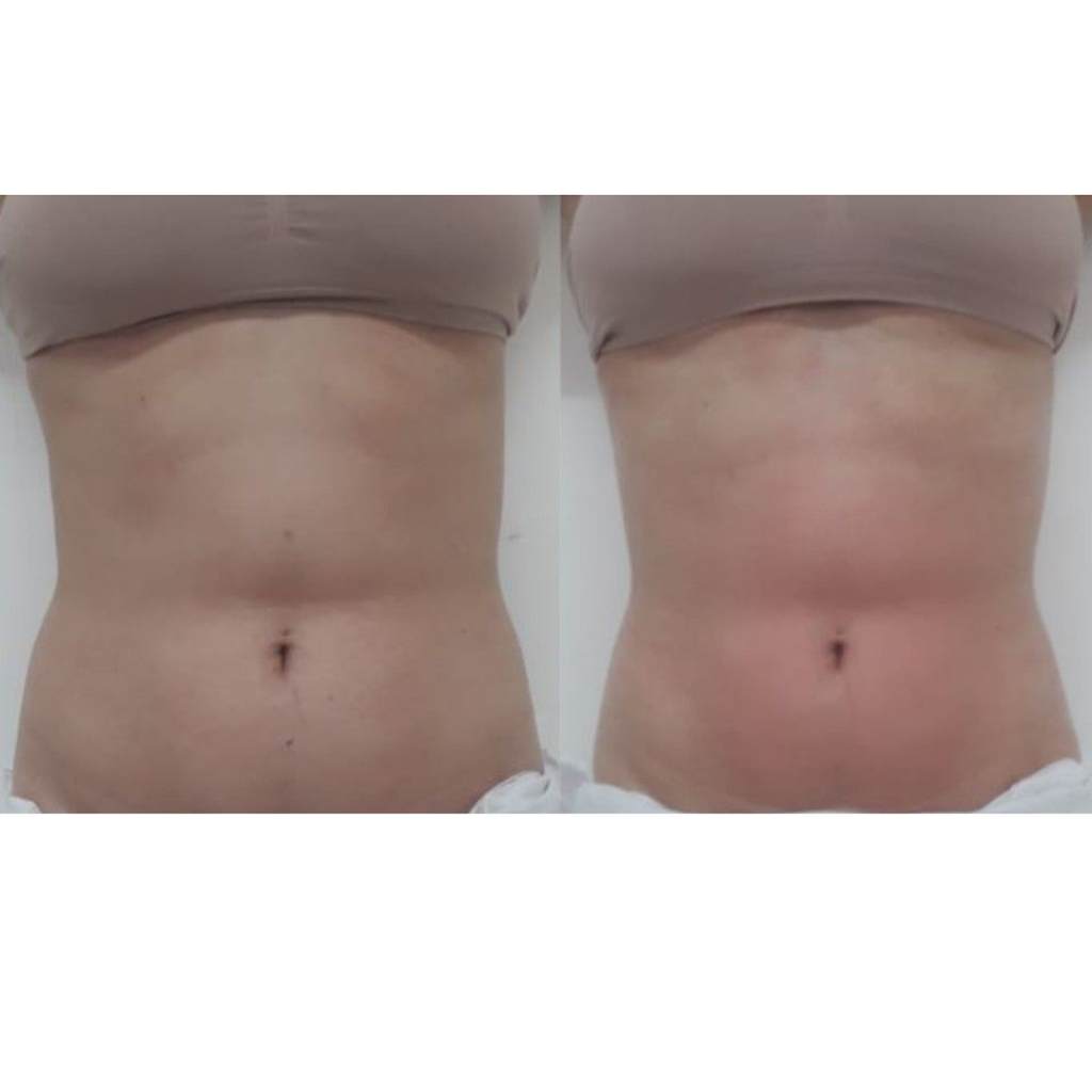 Elite Contours Body Sculpting & Aestheticians Academy | 3 Lymington Rd, Cygnet TAS 7112, Australia | Phone: 0447 840 616