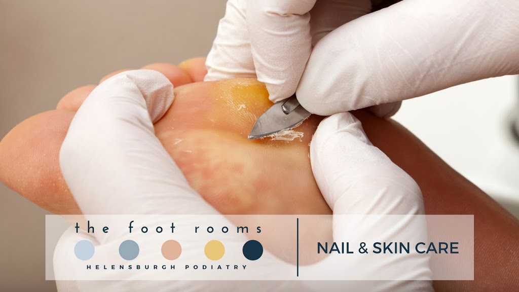 The Foot Rooms Helensburgh Podiatry | 131 Parkes St, Helensburgh NSW 2508, Australia | Phone: (02) 4263 1268