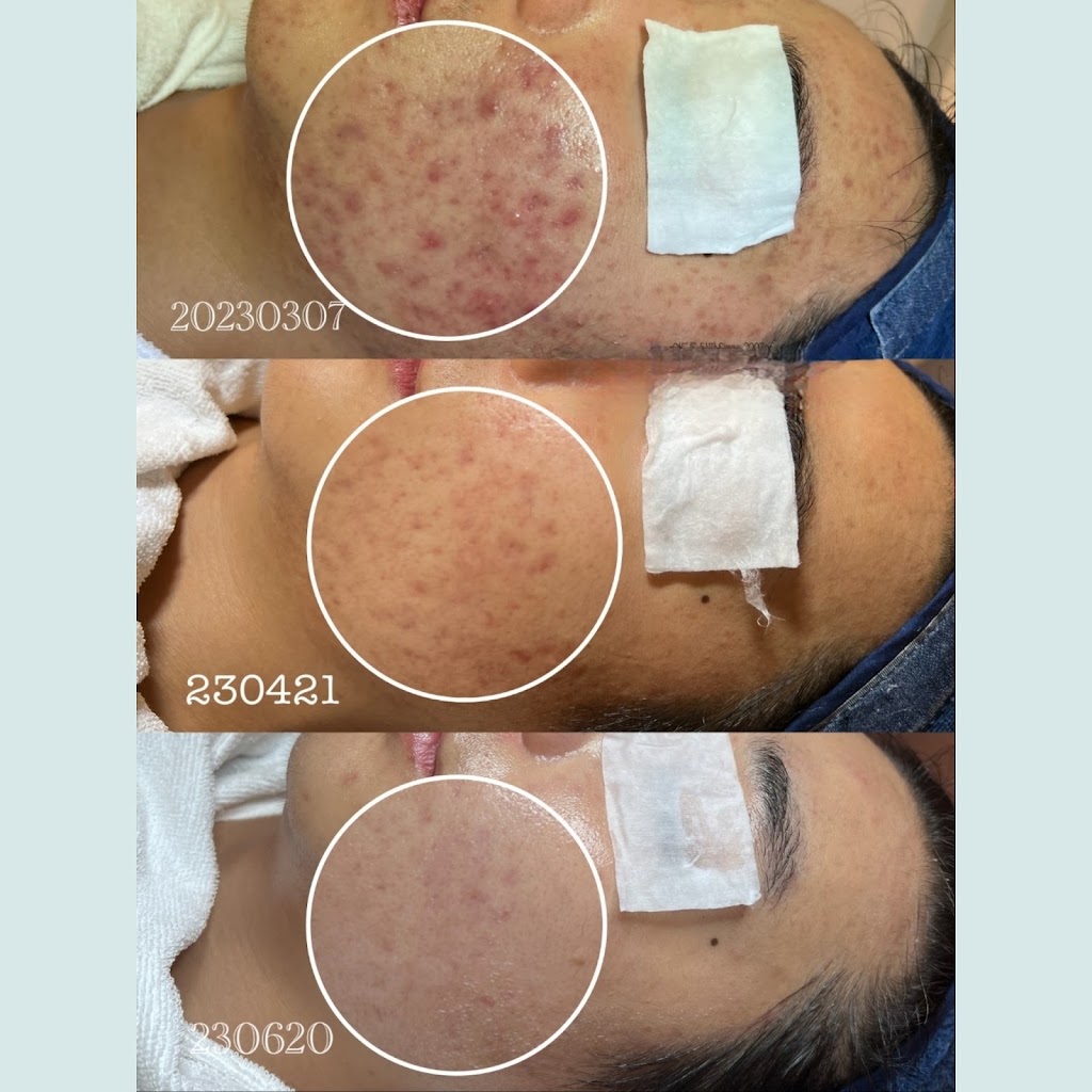 Yuriela & Co beauty | 125 Joseph St, Lidcombe NSW 2141, Australia | Phone: 0417 659 592