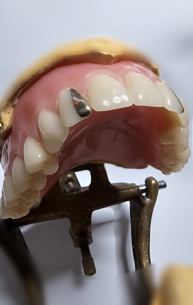 Hill End Dental Laboratory | 8 Majors Ave, Colebee NSW 2761, Australia | Phone: 0410 112 083