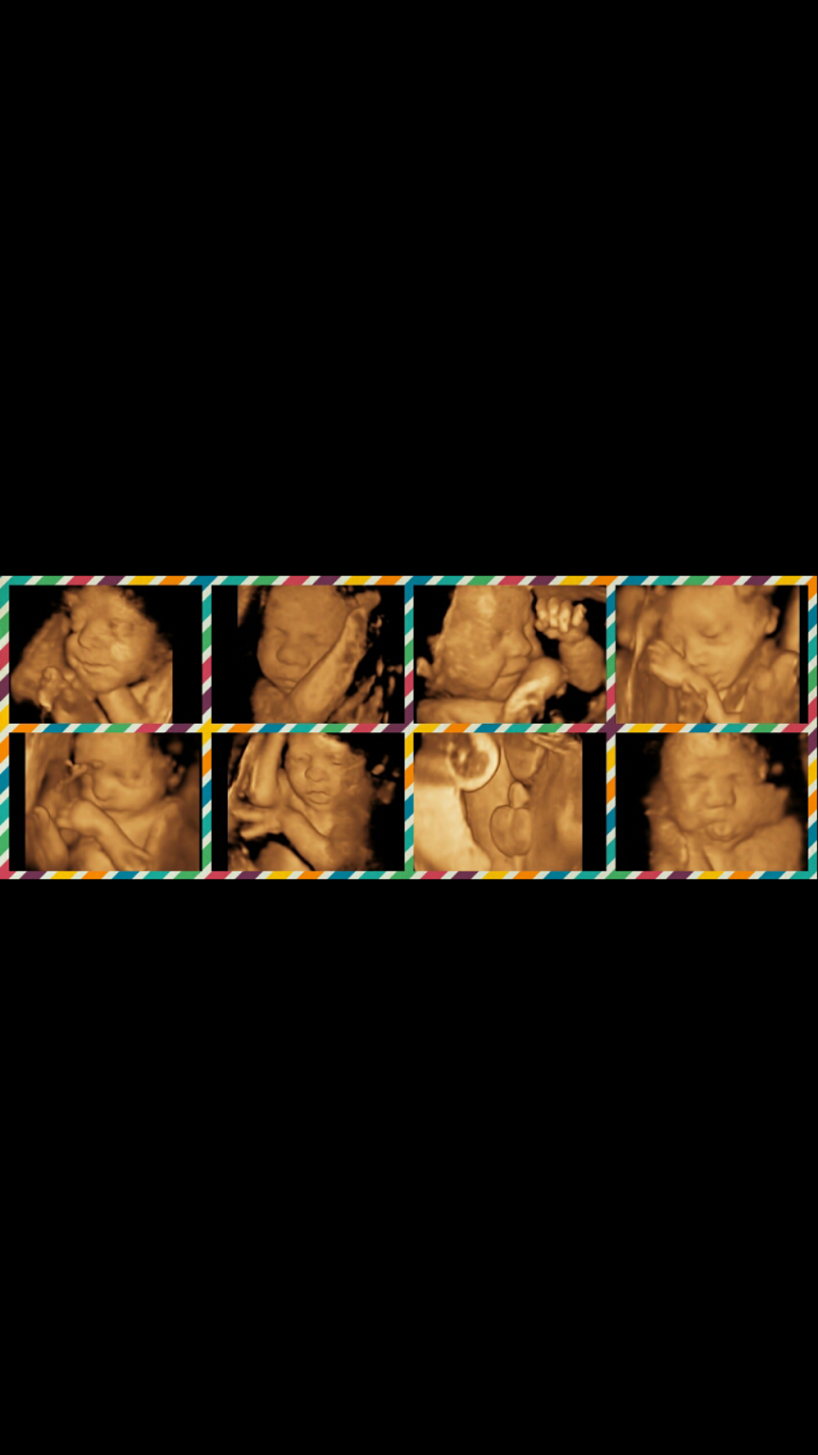 Baby Glimpse 3D/4D ultrasound | 2 Boronia Ave, Burwood NSW 2134, Australia | Phone: 0405 068 603