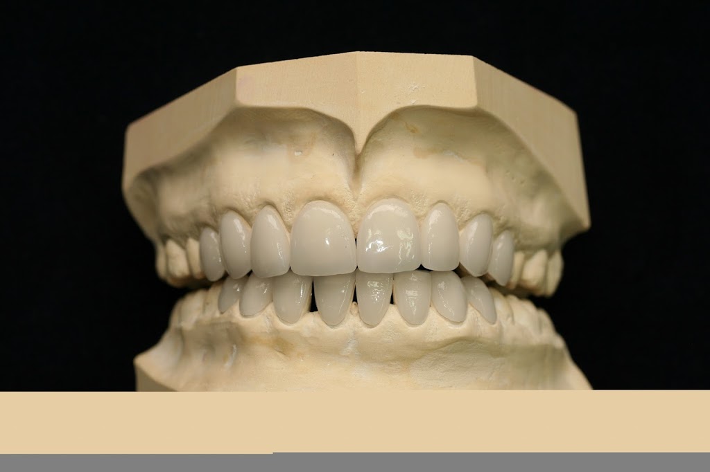Robert Munich Dental Ceramics | dentist | 19 Greenmount Heights, Hillarys WA 6025, Australia | 0894028225 OR +61 8 9402 8225