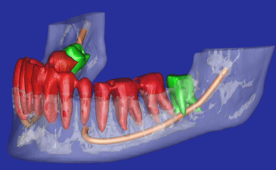 Victorian Dental Imaging Group - Bundoora | 18 Scholar Dr, Bundoora VIC 3083, Australia | Phone: (03) 9473 8555