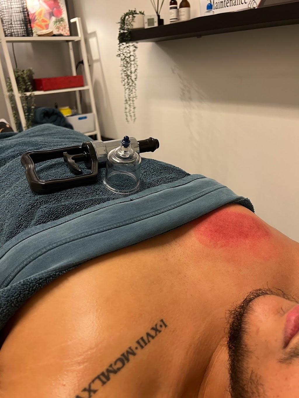 MyoFix Therapy | 1 Monckton Pl, Glenfield NSW 2167, Australia | Phone: 0430 548 866