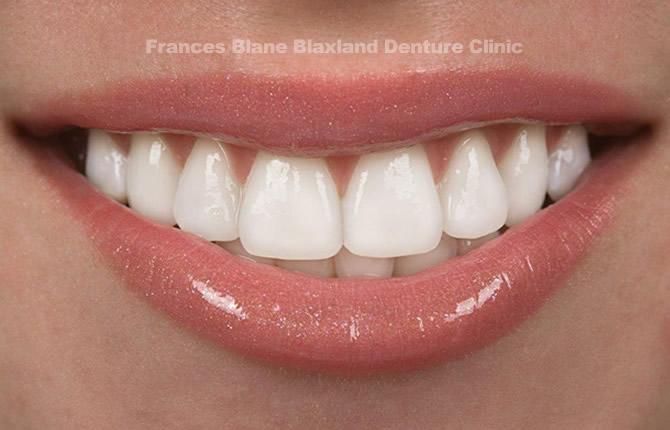 Dental Dentures Denture Clinic |  | 172 Great Western Hwy, Blaxland, Blue Mountains NSW 2774 | 0247390885 OR +61 247390885