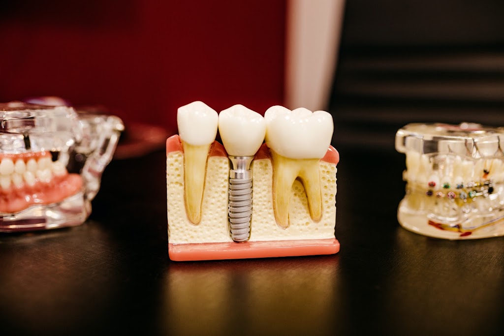 Parkwood Dentistry and Implants | Shop 4, 76/122 Napper Rd, Parkwood QLD 4214, Australia | Phone: (07) 5563 3727