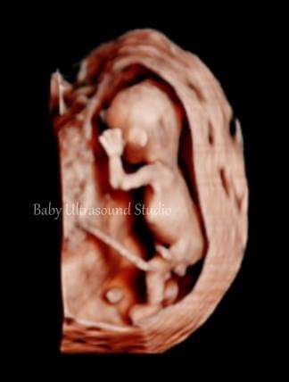 Baby Ultrasound Studio | health | 109 Glenfields Blvd, Mountain Creek QLD 4557, Australia | 0455554420 OR +61 455 554 420