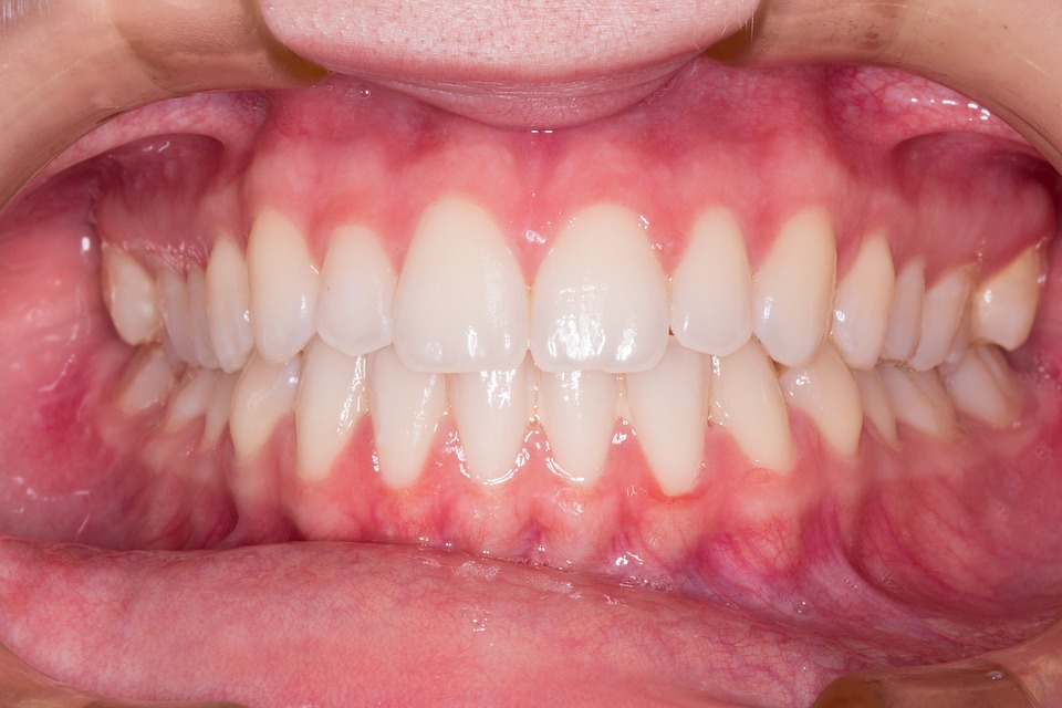 W Dental Baldivis | dentist | Suite 1/9 Atwick Terrace, Baldivis WA 6171, Australia | 0895230552 OR +61 8 9523 0552